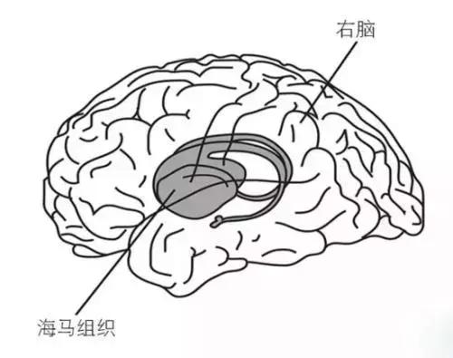 一个月宝宝可以吃DHA吗？关于宝宝营养补充的探讨